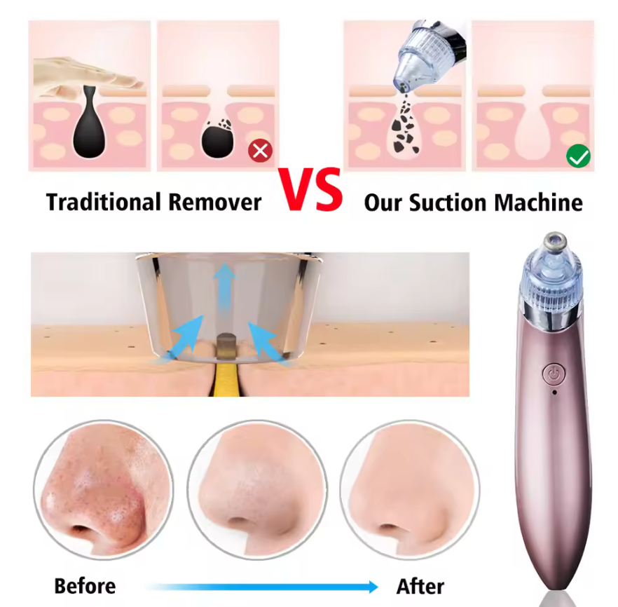 Face Skin Care Electric Blackhead Remover Household Gadget Facial Cleaning Tools